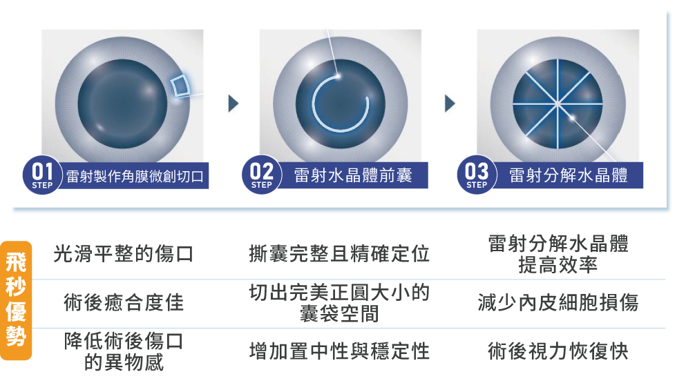 飛秒雷射白內障